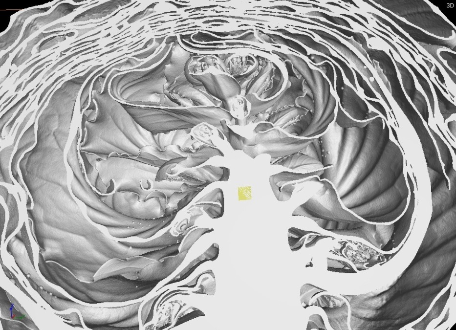 キャベツです。3D-CTで健康診断。