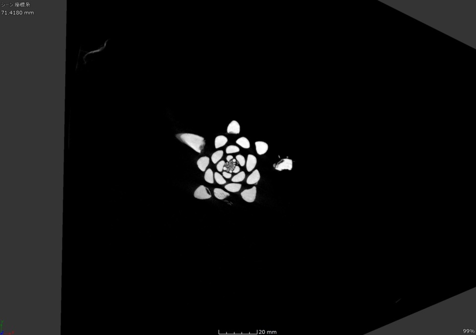 【CT】大根です。健康診断を受診。