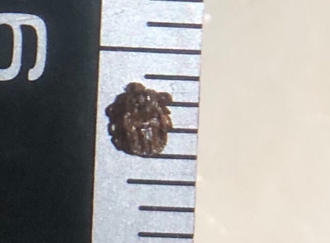 マダニ・このムシにピンときたら…かなりやばい